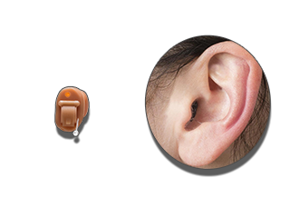 Внутріканальні слуховий апарат